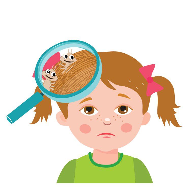Head Lice on a Child
