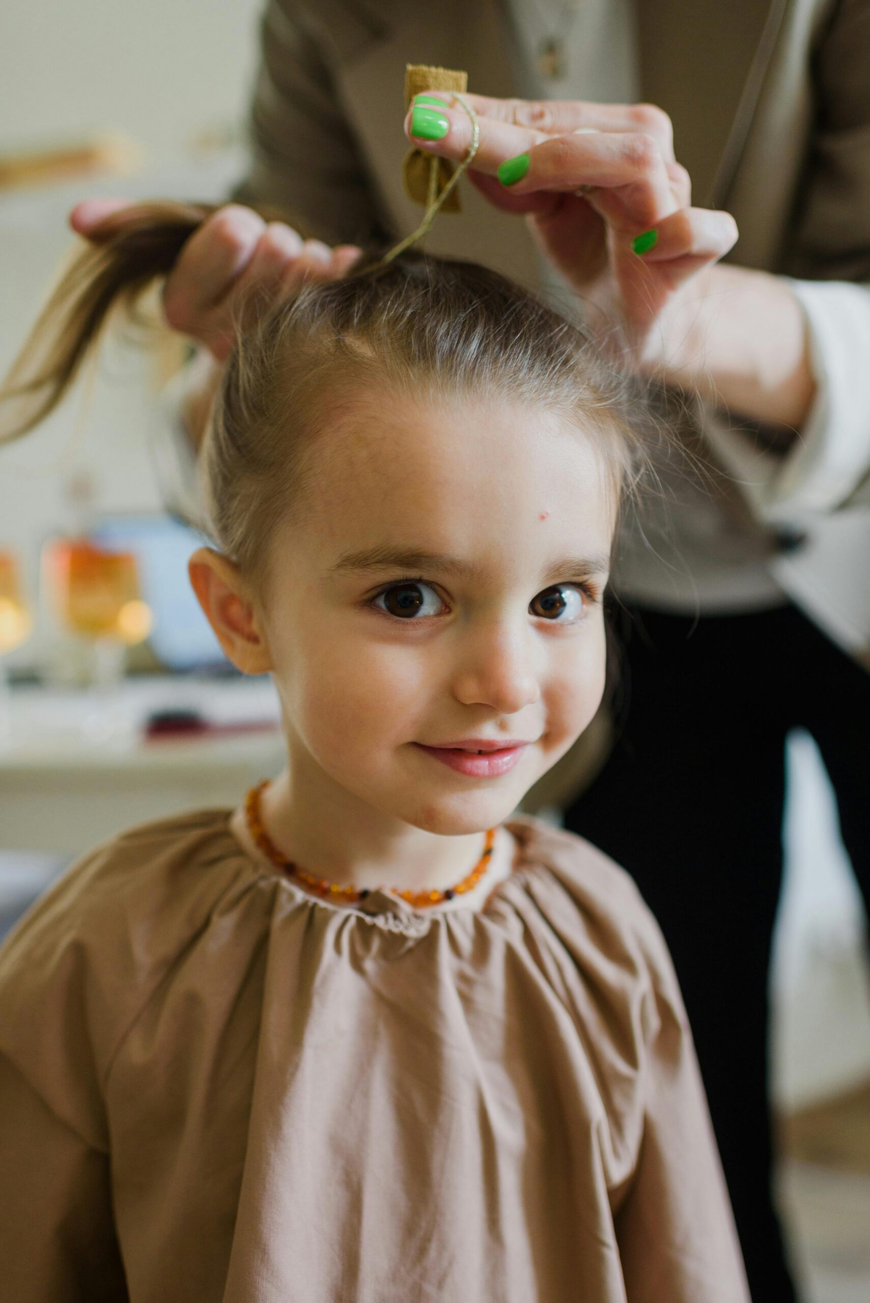 Lice vs. Dandruff: How to Tell the Difference