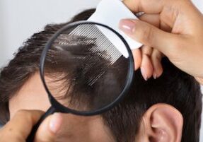 A person carefully combing through a man's hair with a magnifying glass, searching for head lice.